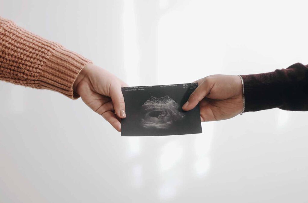 futurs parents tiennent dans leurs mains une échographie du foetus