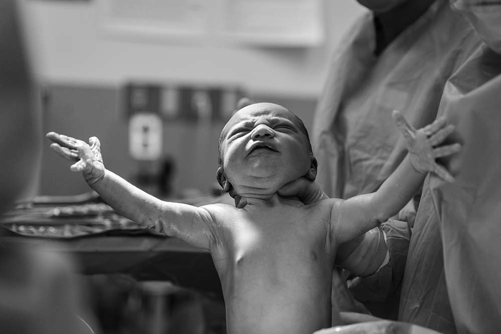 Nouveau-né étendant les bras lors de sa première visite médicale juste après la naissance, capture en noir et blanc mettant en lumière l'importance du 1er rendez-vous médical post-naissance