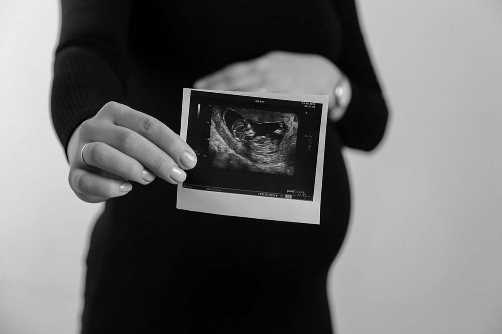 Une femme enceinte tenant une échographie du deuxième trimestre, symbolisant les examens essentiels lors des rendez-vous médicaux de la grossesse, pour souligner l'anticipation et la joie de la maternité.