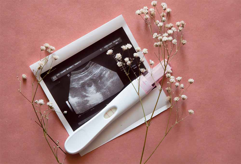 Image échographique et test de grossesse, étapes essentielles du dépistage prénatal pour une maternité heureuse et en bonne santé.