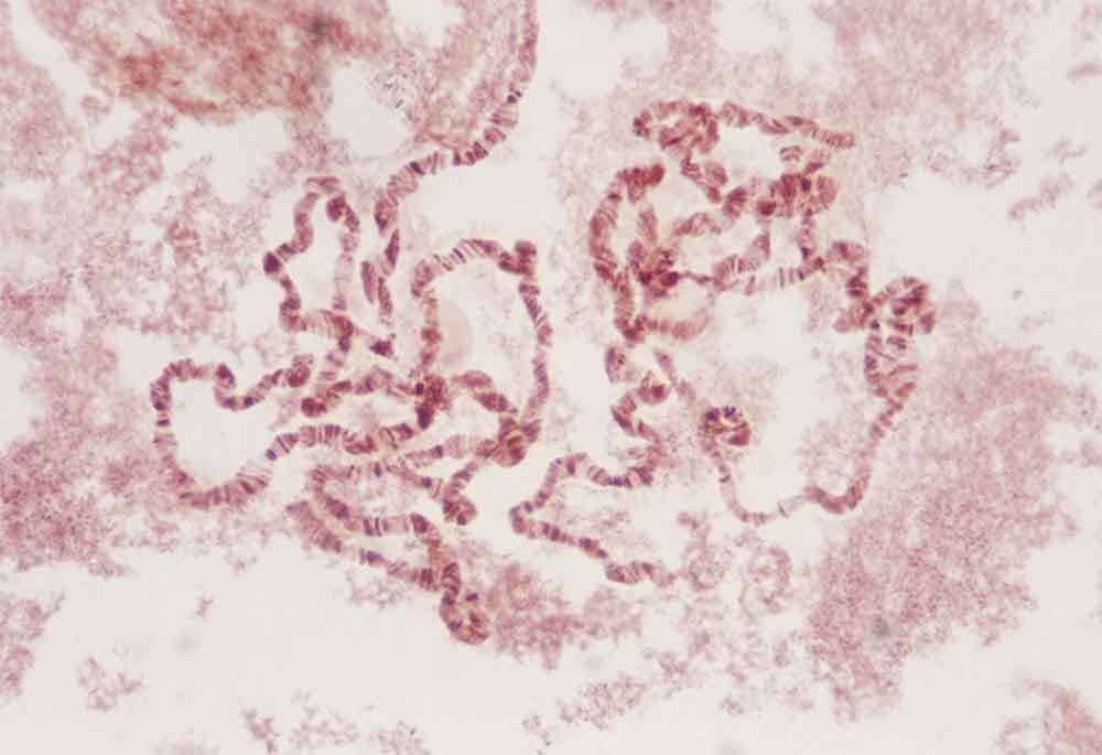 Zoom sur une analyse de cellules pour le dépistage prénatal de la trisomie : comprendre l'importance des tests sanguins pour une grossesse en toute tranquillité.