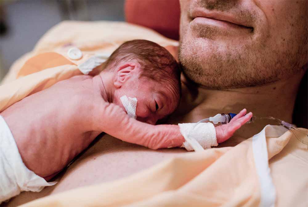 Un moment émouvant de peau à peau entre un père et son bébé prématuré, une pratique qui favorise le lien affectif et soutient la santé et le bien-être des bébés nés prématurément.