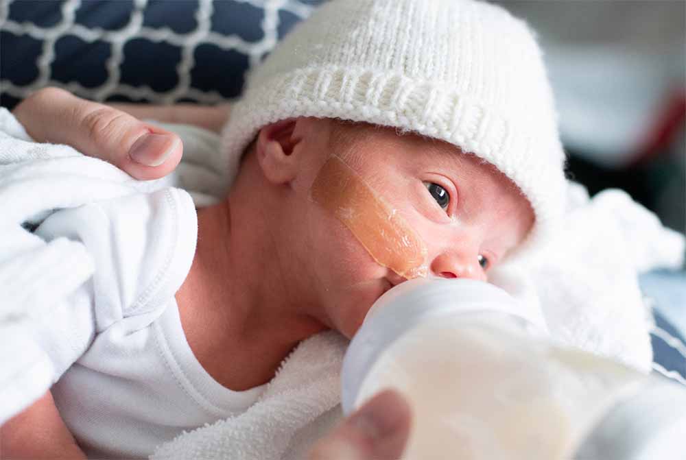 Un bébé prématuré portant un bonnet et une sonde nasale est nourri au biberon, mettant en évidence les méthodes adaptées de nutrition pour les nourrissons nés avant terme, essentielles à leur croissance et à leur développement