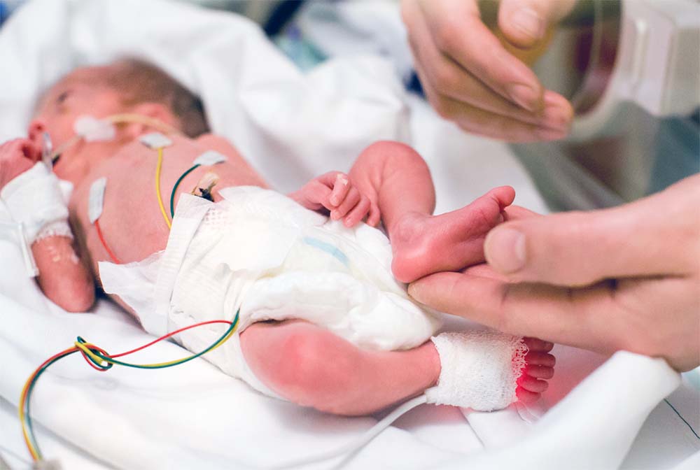 Des soignants prodiguent des soins délicats à un bébé prématuré dans une unité de soins intensifs néonatals, symbolisant les interventions médicales avancées nécessaires pour soutenir la vie et la santé des plus petits et des plus vulnérables.