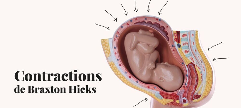 Illustration anatomique des contractions de Braxton Hicks pendant la grossesse