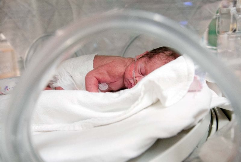Bébé prématuré : 5 réponses à vos questions