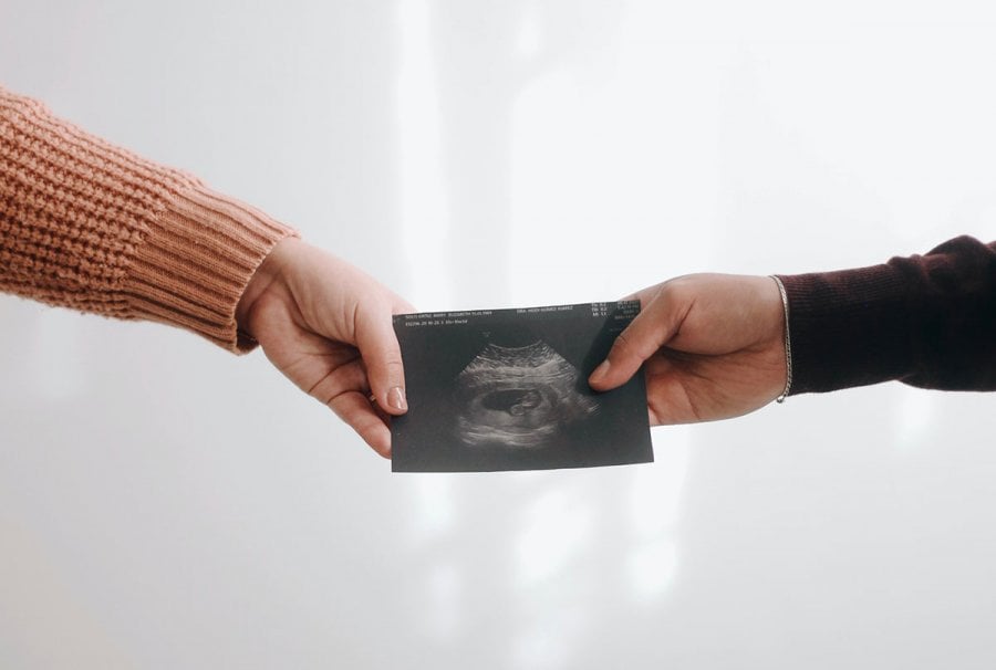 Couple se tenant la main et tenant ensemble une échographie, illustrant les étapes du suivi médical de la grossesse, pour un guide pratique des rendez-vous médicaux de la grossesse.